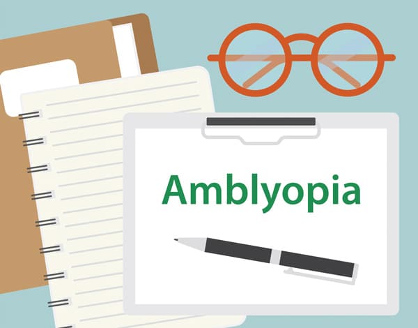 amblyopia is a common eye condition in mississauga. This is also known as lazy eye